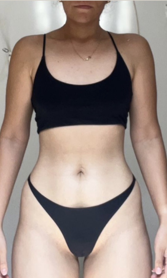 Alicia after