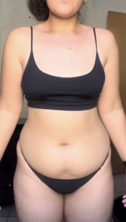 Alicia before